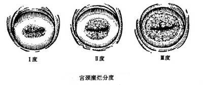 妇科疾病图谱