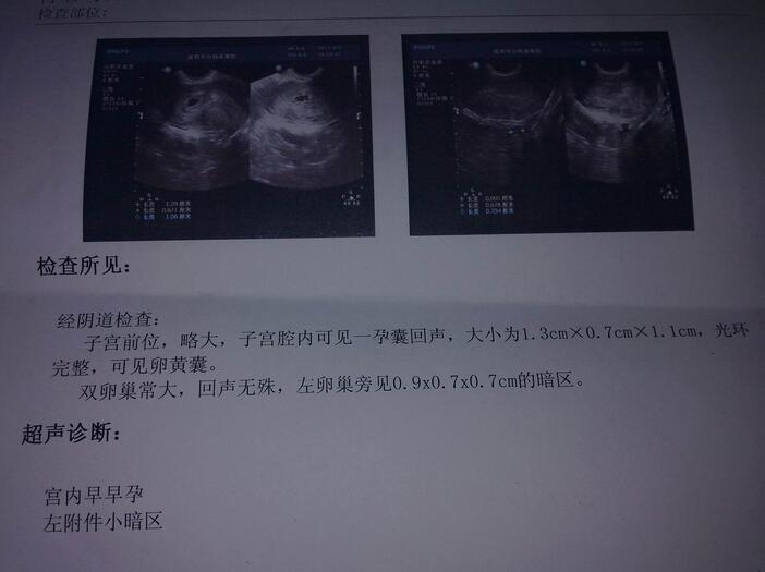 B超化验单